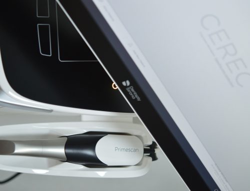 Same Day Dental Crowns and Bridges at SmileBright Dental